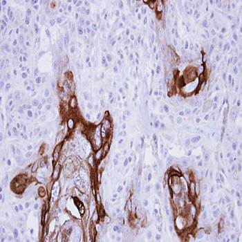 ZC3H12A antibody