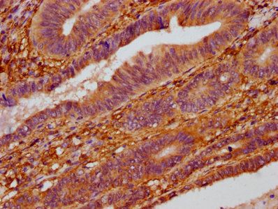 ZC3H14 Antibody