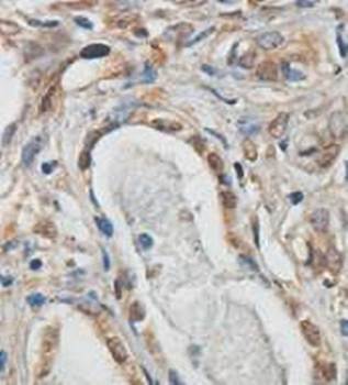ZC3H14 Rabbit Polyclonal Antibody