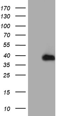 ZC3H8 Antibody