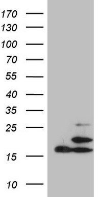 ZC3H8 Antibody