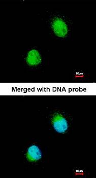 ZC3H8 antibody