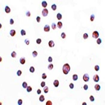 ZC3HAV1 Antibody