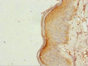 ZC3HC1 Antibody