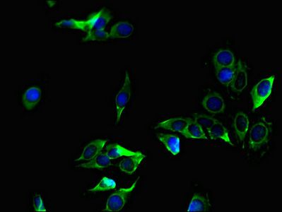 ZC4H2 Antibody