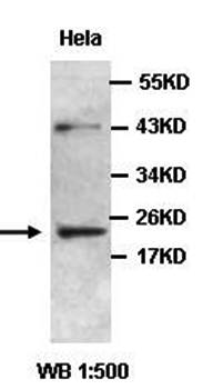 ZC4H2 antibody