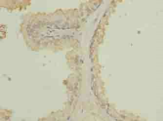 ZCCHC13 Antibody