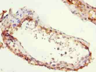 ZCCHC13 Antibody