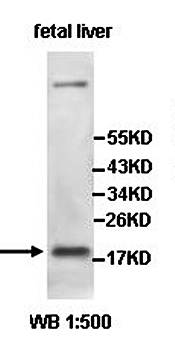 ZCCHC13 Rabbit Polyclonal Antibody