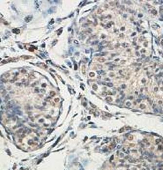 ZCCHC13 Rabbit Polyclonal Antibody