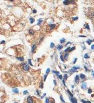 ZCCHC4 Rabbit Polyclonal Antibody