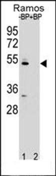 ZDHC2 antibody