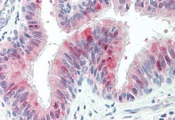 Goat anti-HIP14L / ZDHHC13 Antibody