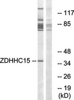 ZDHHC15 Antibody