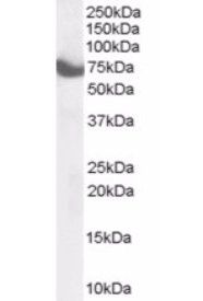 HIP14/ZDHHC17 Antibody