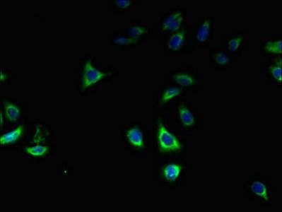 ZDHHC2 antibody