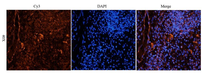 ZDHHC2 antibody