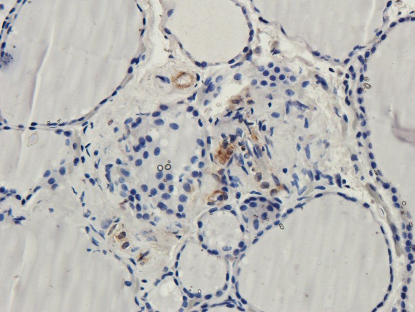 ZDHHC2 antibody