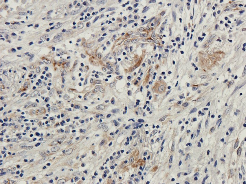 ZDHHC2 antibody