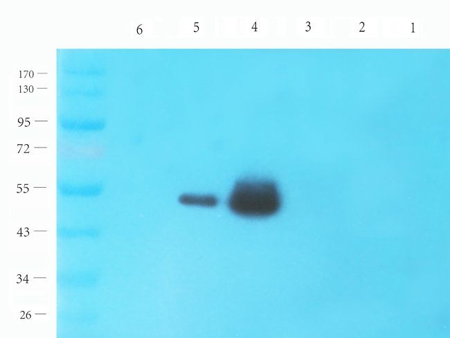 ZDHHC2 antibody