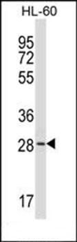 ZDHHC24 antibody