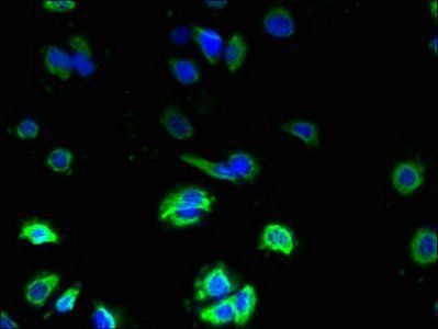 ZDHHC3 Antibody