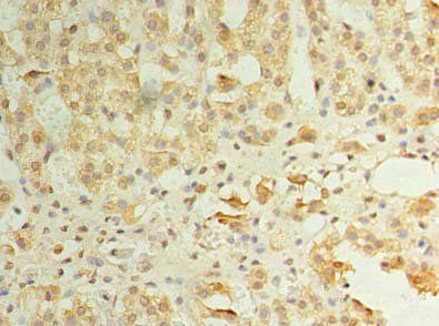 ZDHHC3 Antibody