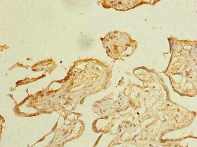 ZDHHC3 Antibody