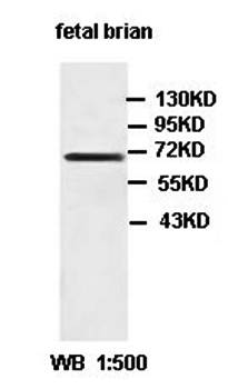 ZDHHC5 antibody