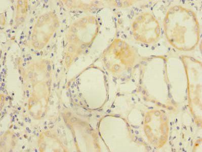 ZDHHC6 Antibody
