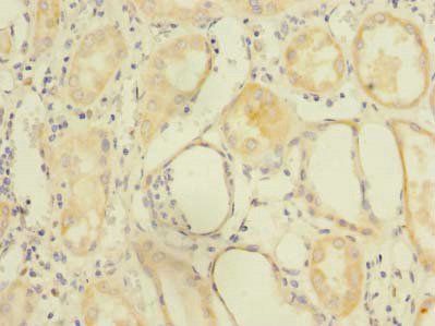 ZDHHC6 antibody