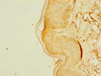 ZDHHC6 Antibody