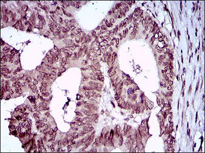 ZEB1 Antibody