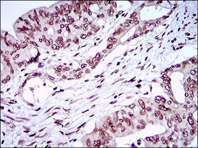 ZEB1 Antibody