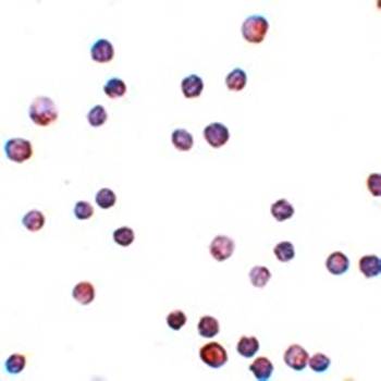 ZEB1 Antibody
