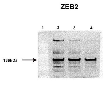ZEB2 antibody