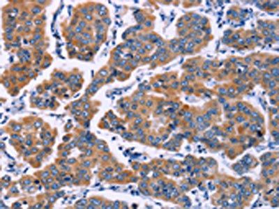 ZEB2 Antibody