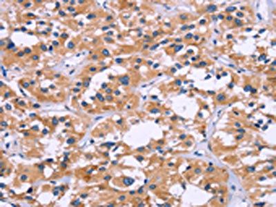 ZEB2 Antibody