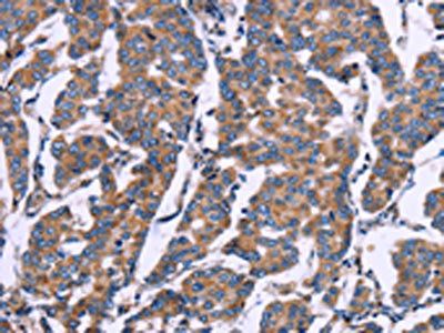 ZEB2 Antibody