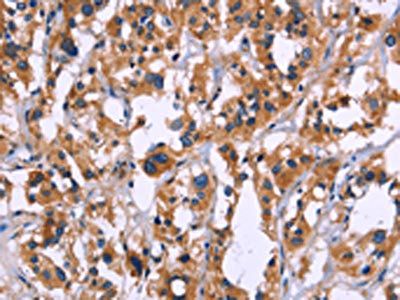 ZEB2 Antibody
