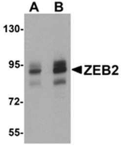 ZEB2 Antibody