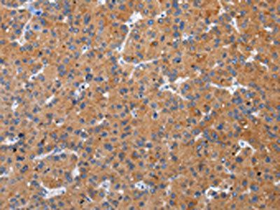 ZFAND2A Antibody