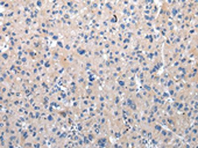 ZFAND2A Antibody