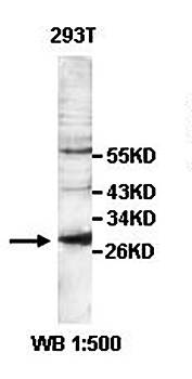 ZFAND2B Rabbit Polyclonal Antibody