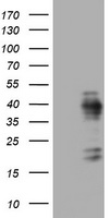 ZFAND3 Antibody