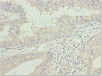 ZFAND3 Antibody