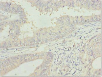 ZFAND3 antibody