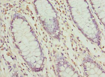 ZFAND3 Antibody
