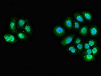 ZFAND6 Antibody