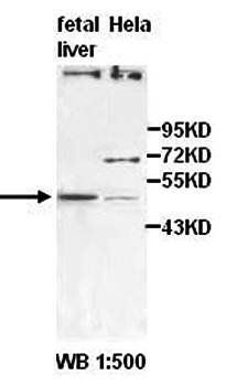 ZFP161 Rabbit Polyclonal Antibody